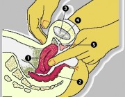 El tacto vaginal: Examen exploratorio