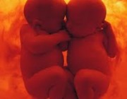 Diagnóstico de una ecografía transvaginal en el embarazo