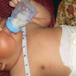 Informe sobre los nacimientos prematuros