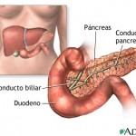 México: Recomendaciones para mujeres con diabetes gestacional