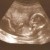 Imagen de avatar
