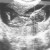 Imagen de avatar