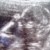 Imagen de avatar