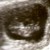 Imagen de avatar