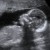 Imagen de avatar