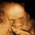 Imagen de avatar