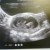 Imagen de avatar
