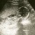 Imagen de avatar