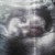 Imagen de avatar