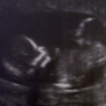 Foto del perfil de chapis27