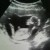 Foto del perfil de Karen De Mendez