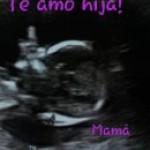 elembarazo ayeefernandez