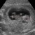 Imagen de avatar