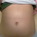 elembarazo anabel10