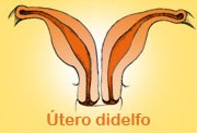 El útero doble: embarazo de altísimo riesgo