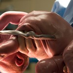 Ventajas de las células del cordón umbilical