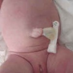 Manten seco el cordón umbilical para evitar infecciones