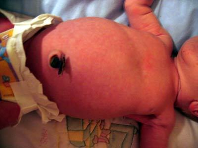 ¿Cuándo se cae el cordón umbilical?