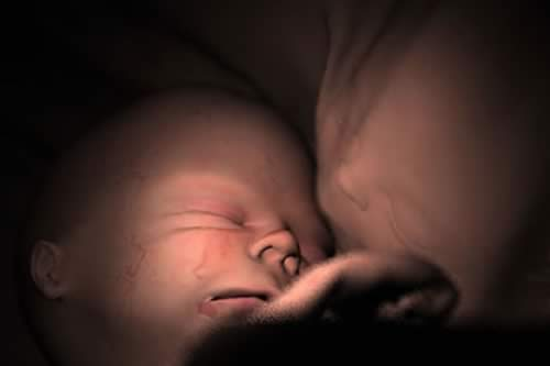 Los partos prematuros afectan la salud del bebé