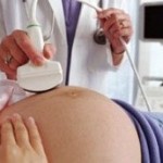 En un embarazo con lupus, la visita al médico debe ser mas constante