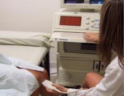 ¿Cómo sé si tengo una malformación uterina?