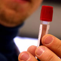 Pruebas de sangre para detectar la sífilis