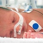Uno de los riesgos del embarazo tardío es el nacimiento de bebes prematuros