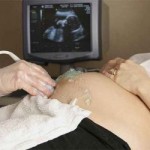 prueba embarazo ecografia