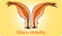 utero didelfo