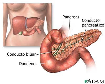 Diabetes gestacional