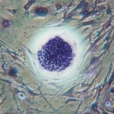 células madre 3