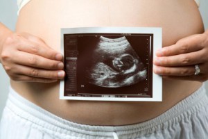 Ecografía de 20 semanas de embarazo