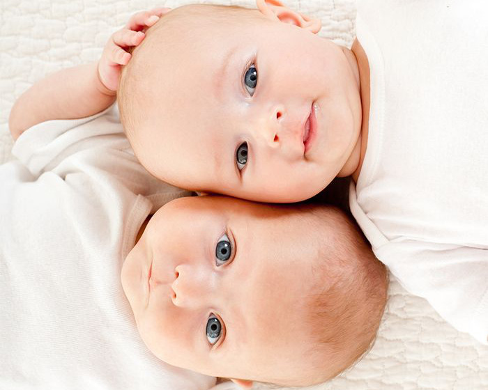 La amniocentesis en gemelos