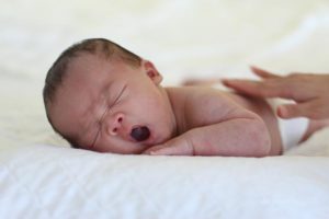 Causas de la ictericia en el recién nacido
